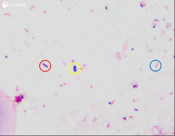 赤丸：グラム陽性桿菌、青丸：グラム陰性桿菌、黄丸：芽胞